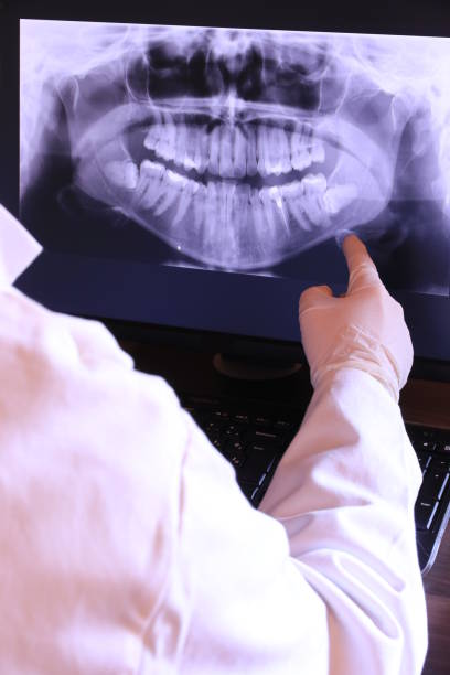Best Emergency Dental Care for Broken or Chipped Teeth in Argos, IN